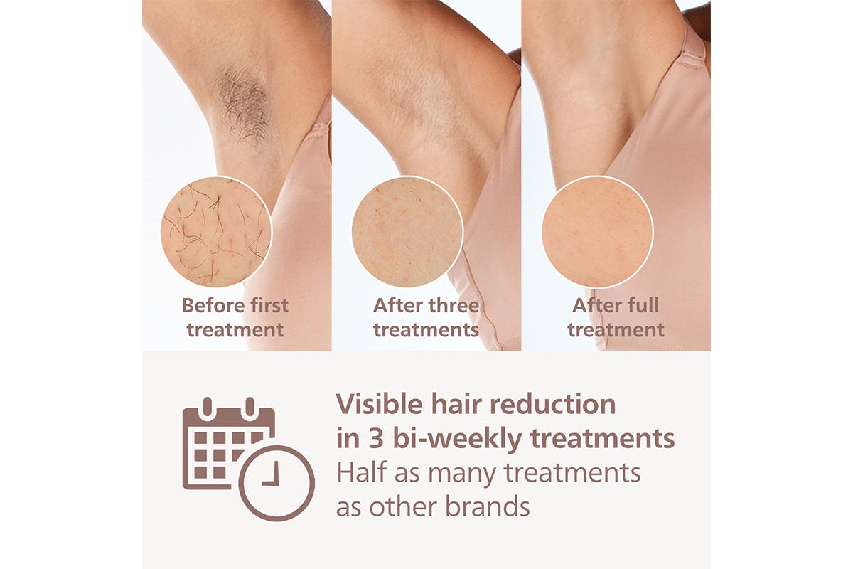 Philips Lumea 8000 Series IPL Hair Removal Device | BRI945/00-3