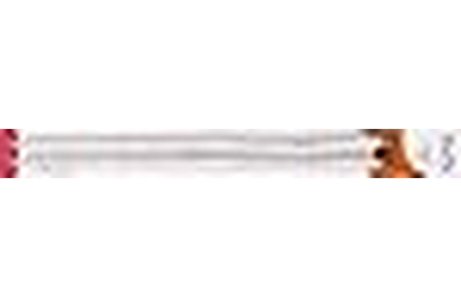 Knitpro Gro-kp10202 - Nova Metal Knitting Pins Single-ended-3