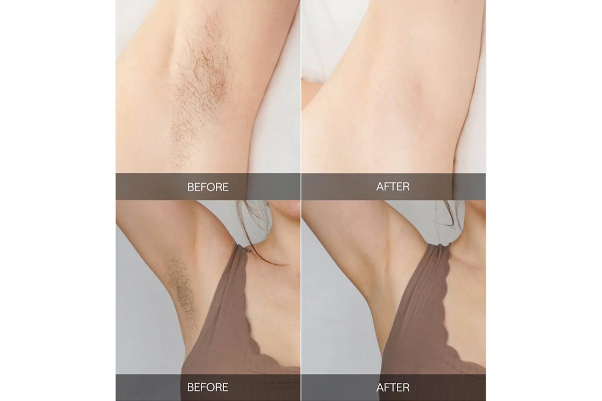 Ulike Air 2 IPL Hair Removal Device | UI04-GR-UK-4