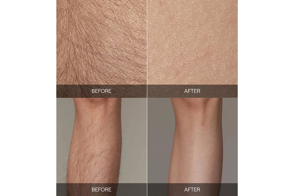 Ulike Air 2 IPL Hair Removal Device | UI04-GR-UK-5